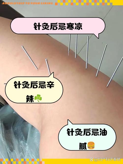 针灸后病情加重正常吗