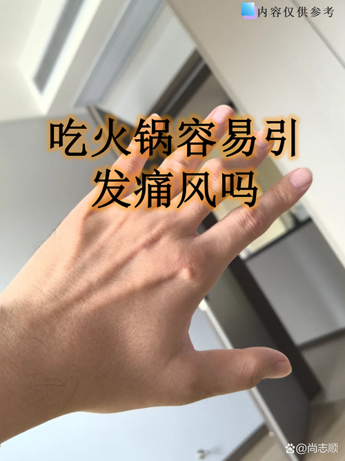 为什么痛风不能吃火锅