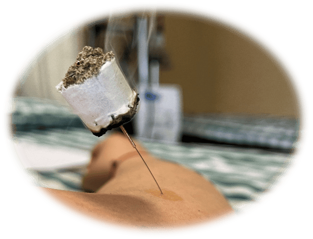 针灸促排卵成功率高吗