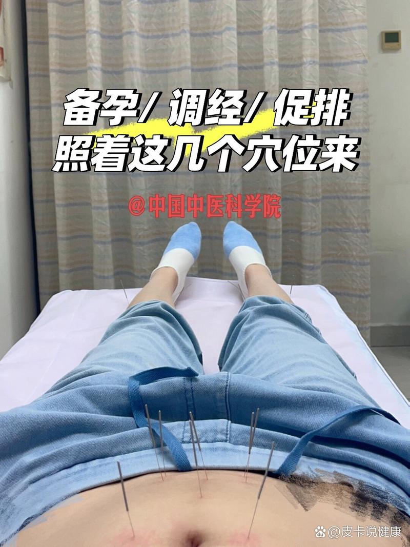 针灸促排卵成功率高吗