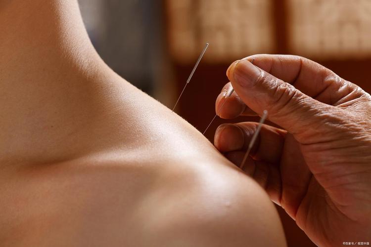 针灸减肥的效果怎么样