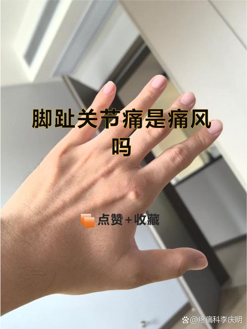 小脚趾痛可能是痛风吗