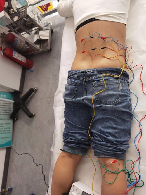 来例假能不能腰椎针灸