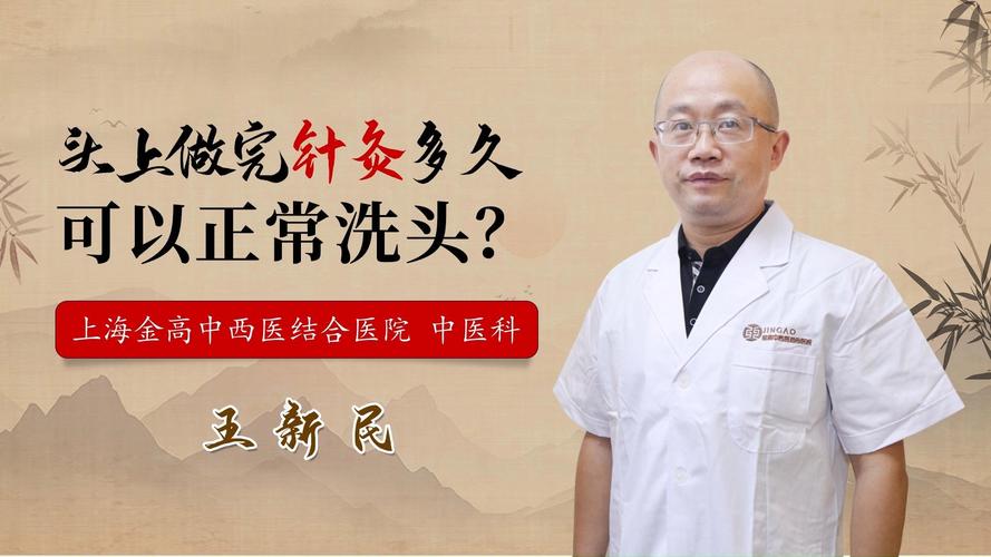 头部针灸后多久能洗头