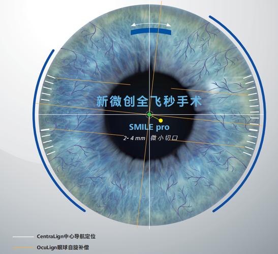 西安全飞秒smile