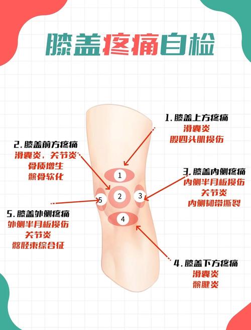 膝盖痛是痛风的症状吗