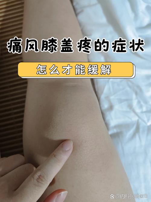 膝盖痛是痛风的症状吗