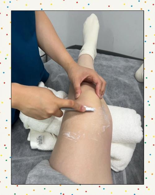 半月板损伤针灸管用吗