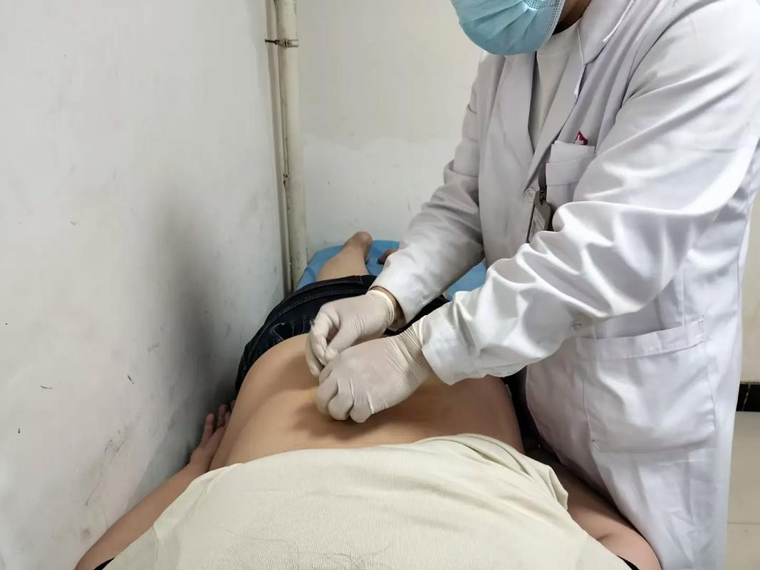 针灸埋线减肥多久见效