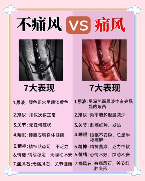 青少年得痛风能治好么