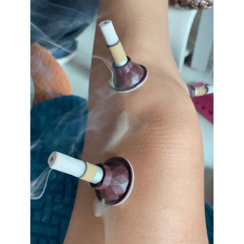 滑膜炎针灸效果怎么样