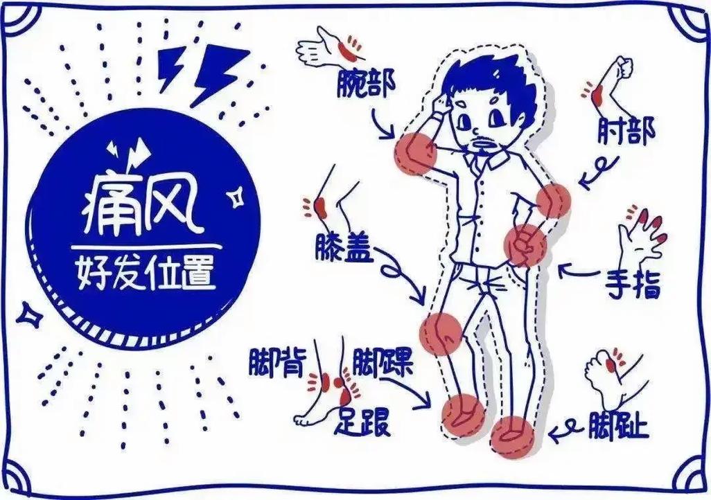 原发性痛风的发病原因