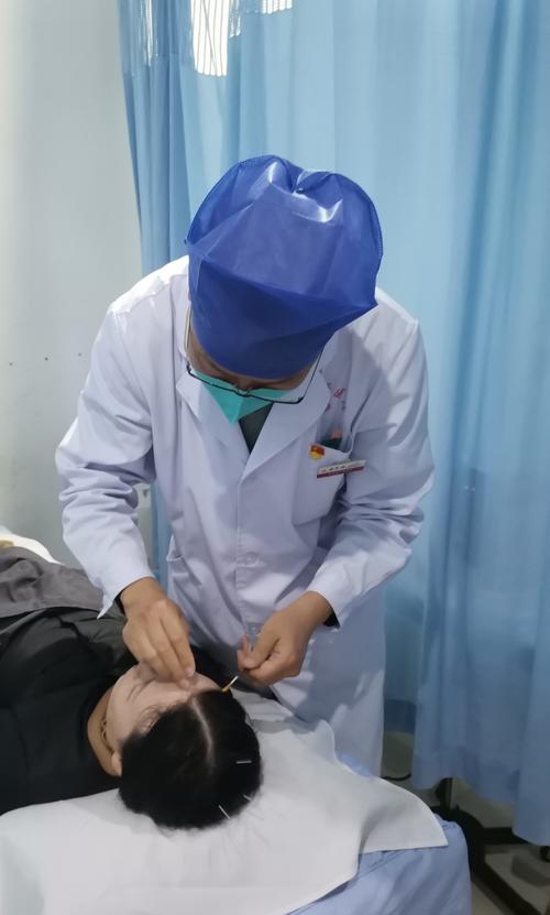 神经性耳鸣针灸有效吗