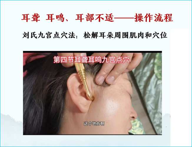 神经性耳鸣针灸有效吗