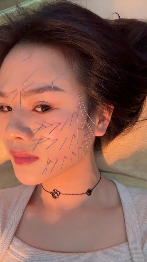 面部针灸美容视频大全