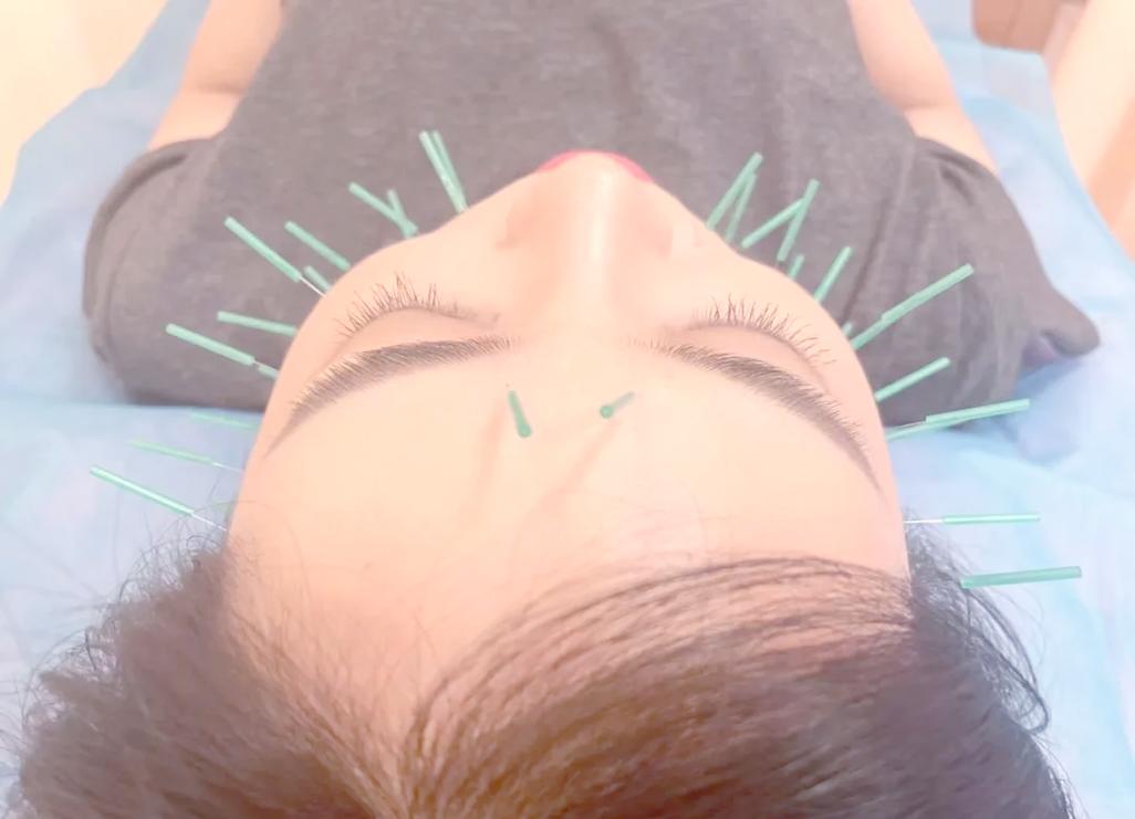 面部针灸美容视频大全