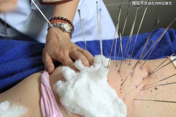 针灸后肚子疼怎么回事