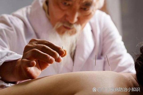 针灸后肚子疼怎么回事