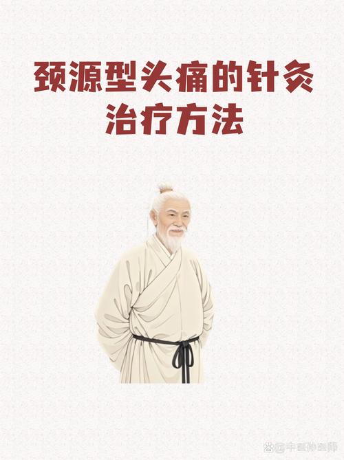 神经性头疼可以针灸吗