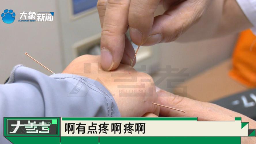 腓总神经损伤针灸治疗