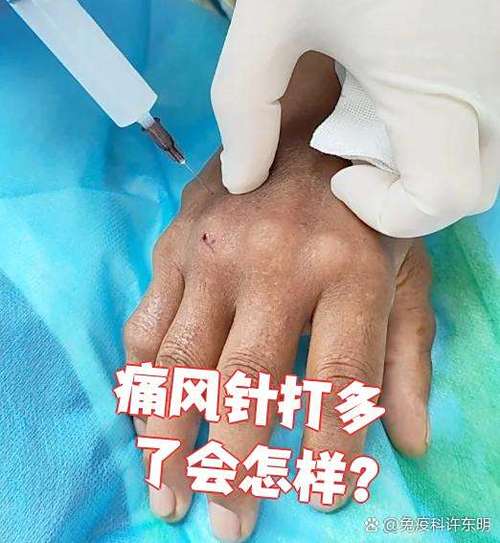 痛风挂的点滴是叫什么