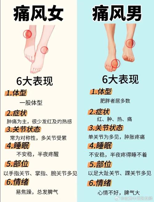 脚关节痛风的治疗方法