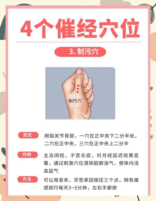 月经期间可以扎针灸吗