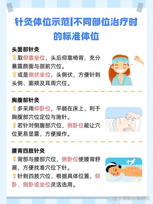 针灸要扎多久才有效果