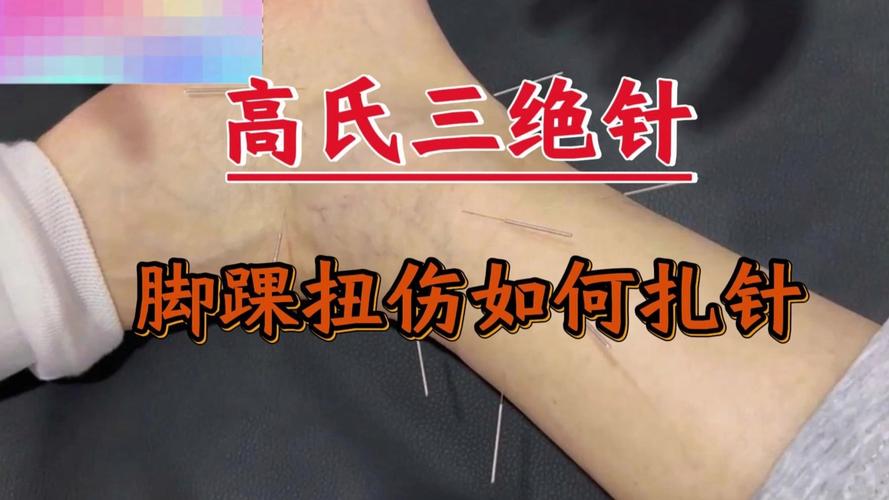 针灸教学视频140集