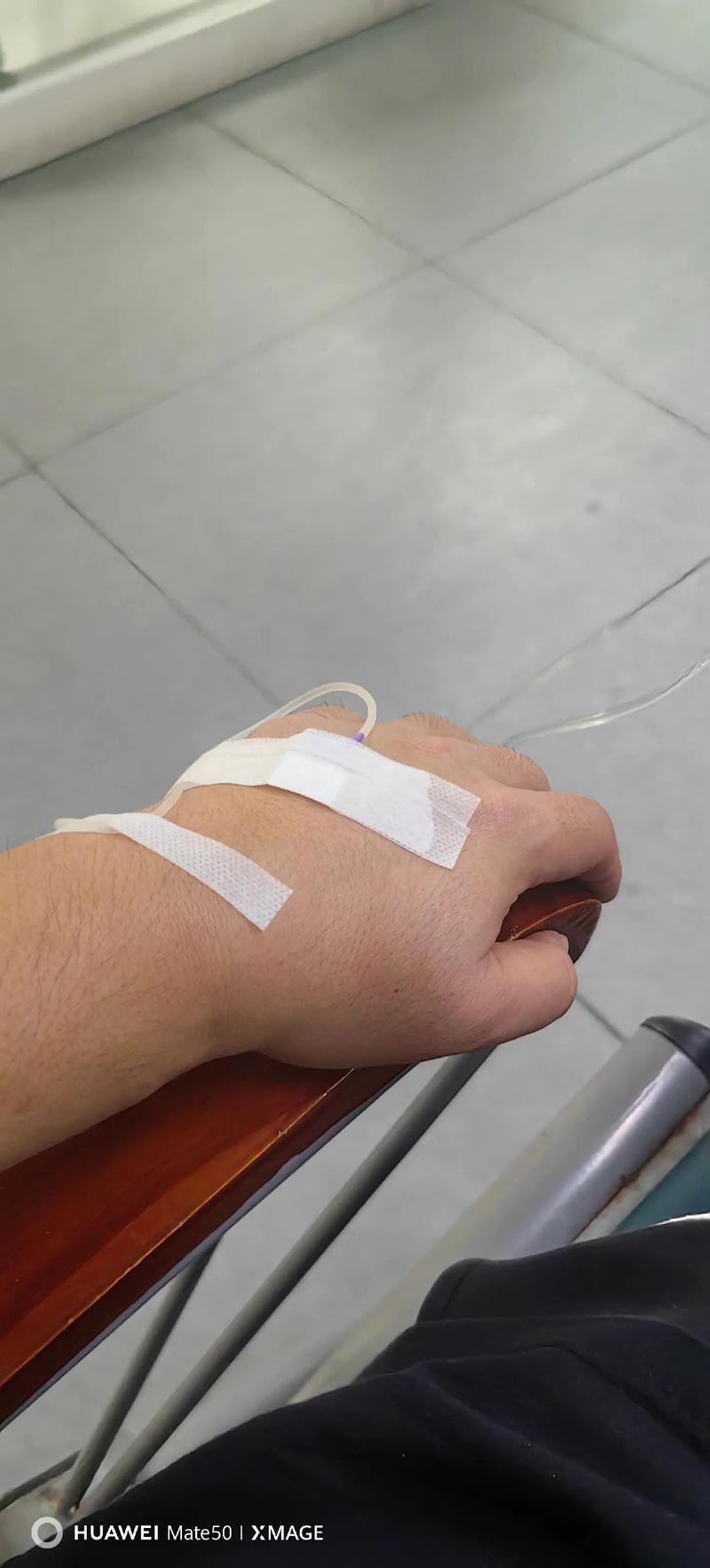 痛风打什么点滴好得快