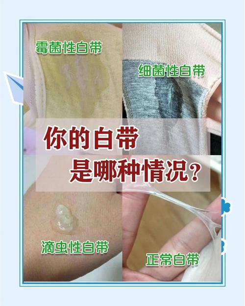 安全期应不应该有白带