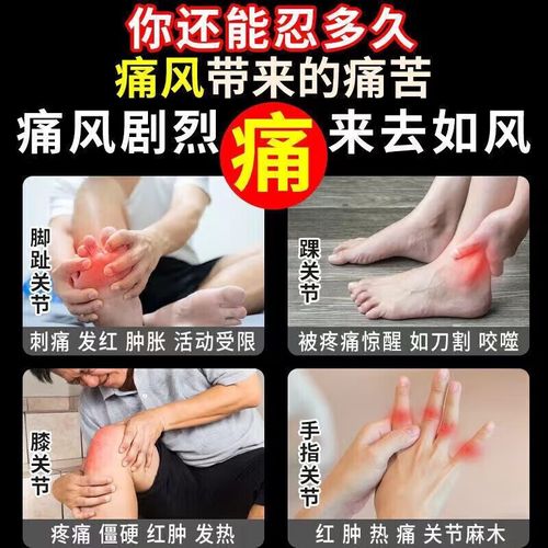 痛风可以吃小苏打片吗