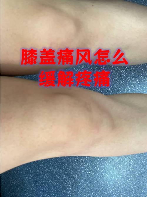 痛风会不会引起膝盖疼