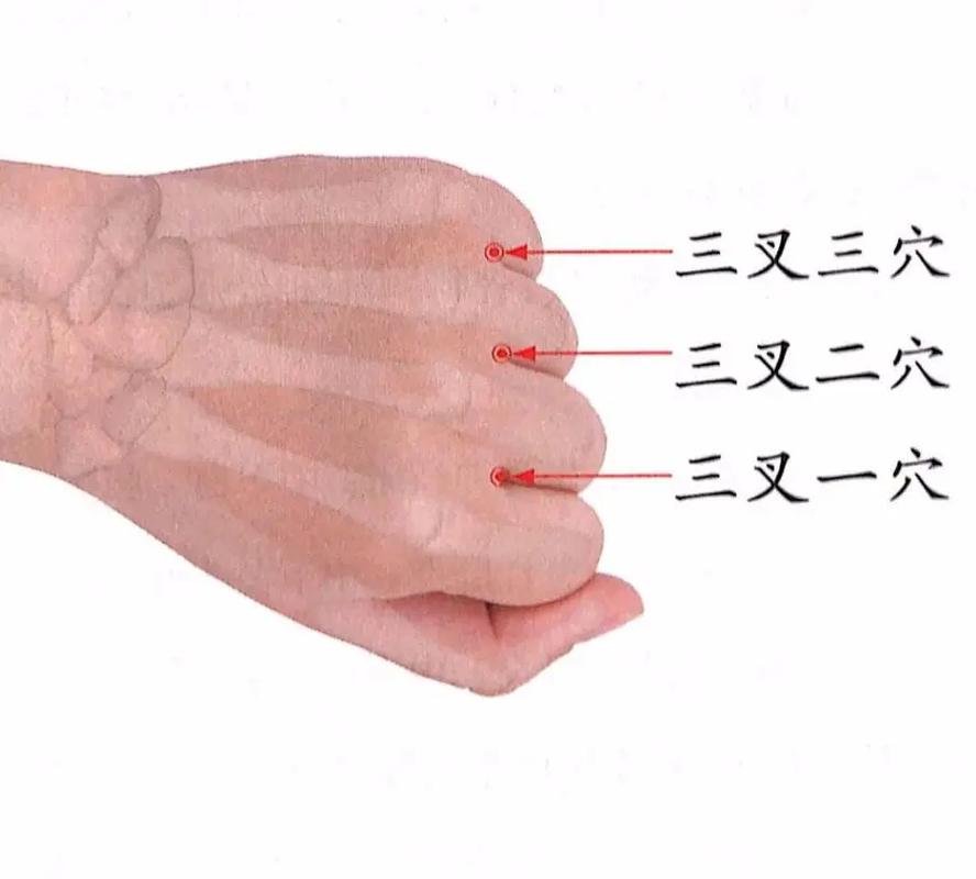 肩周炎的针灸治疗方法