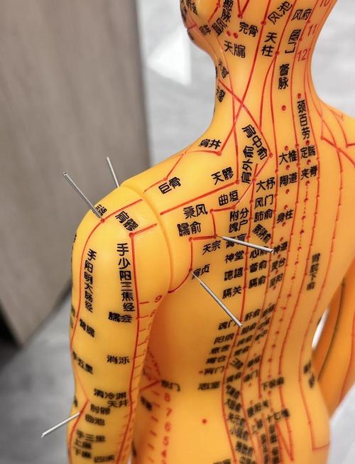 针灸可以治疗肩周炎吗