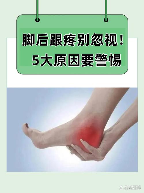 脚后跟痛是痛风的症状