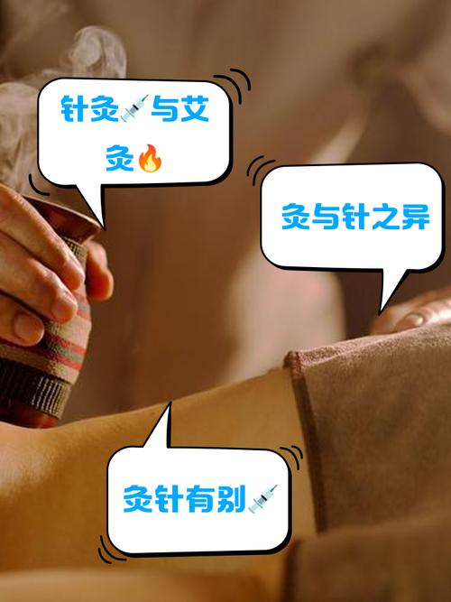 针灸和艾灸哪个效果好