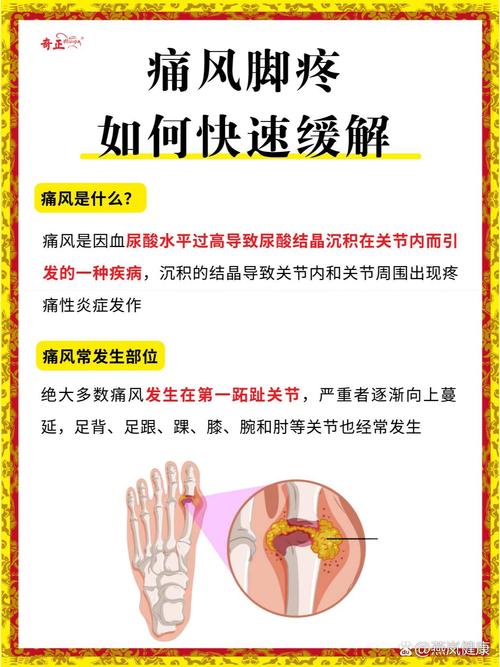 痛风经常痛是怎么回事