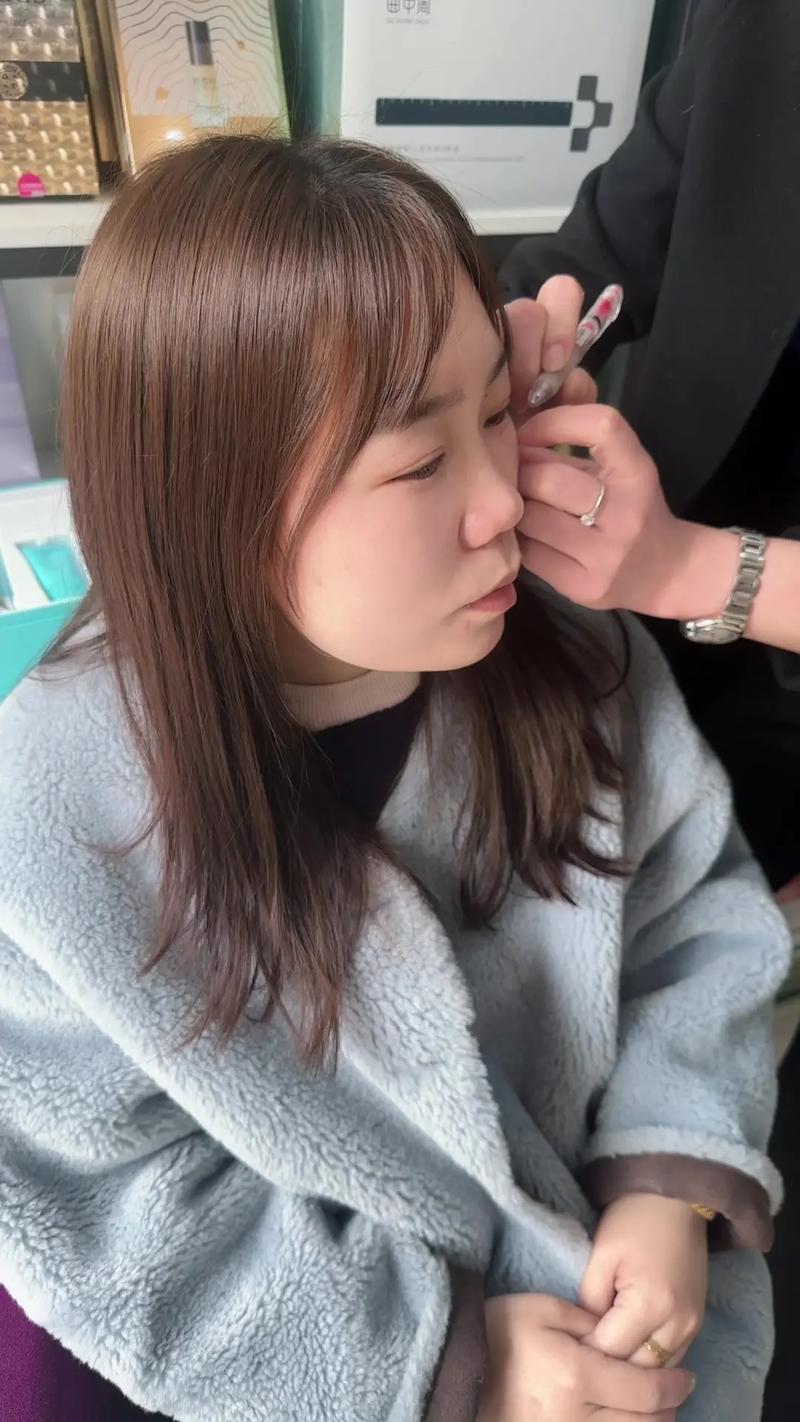 曲中周祛斑是安全的吗