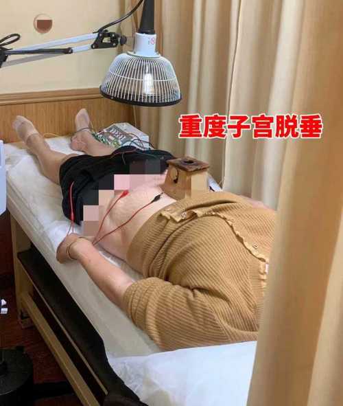 董氏针灸治疗子宫肌瘤