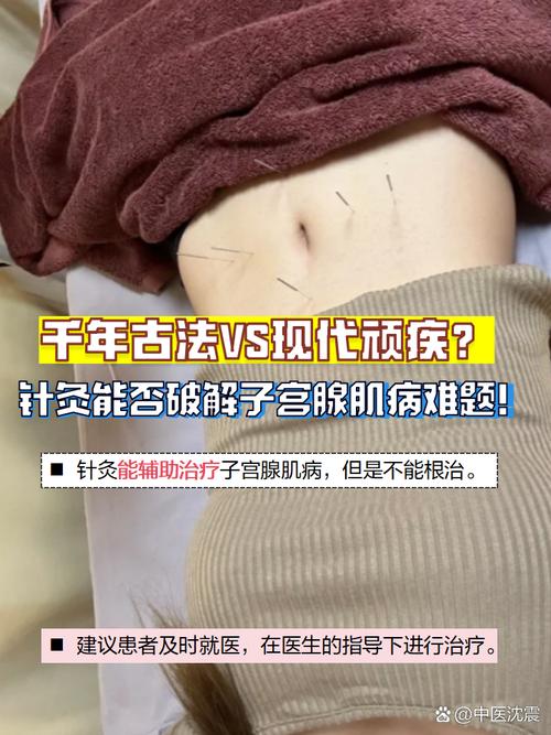 子宫针灸后有什么反应