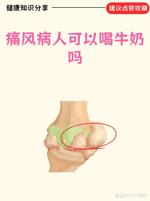 痛风病人可以喝牛奶吗