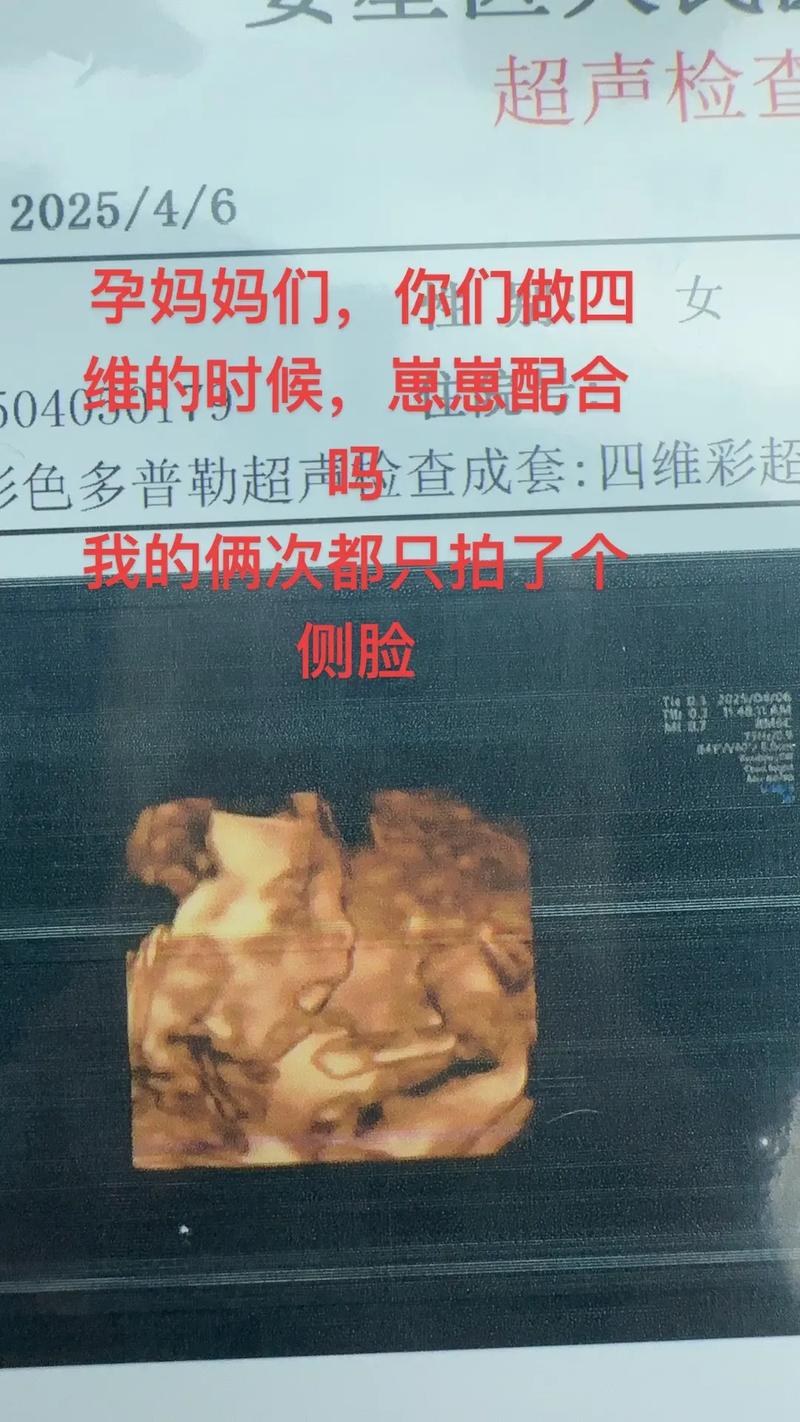 四维只看到侧脸安全吗