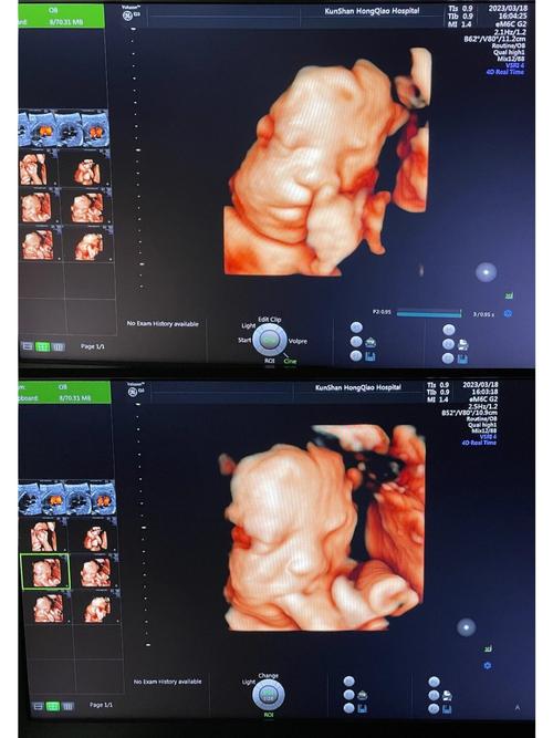 四维只看到侧脸安全吗