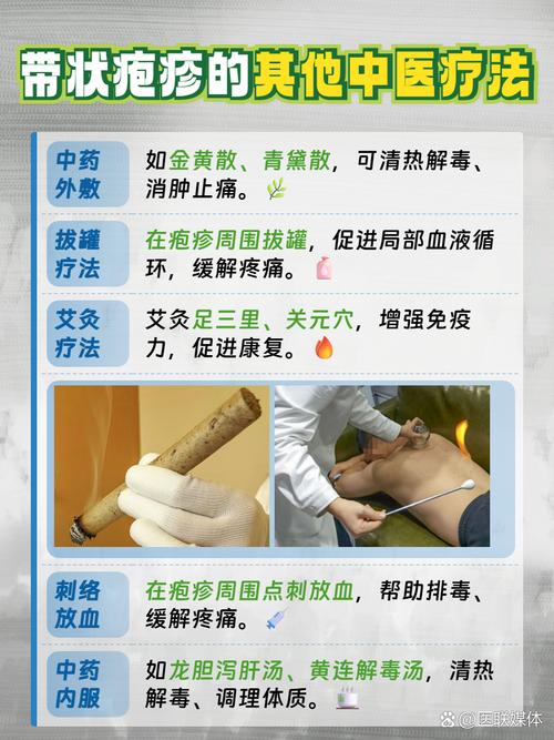 带状疱疹针灸哪些部位