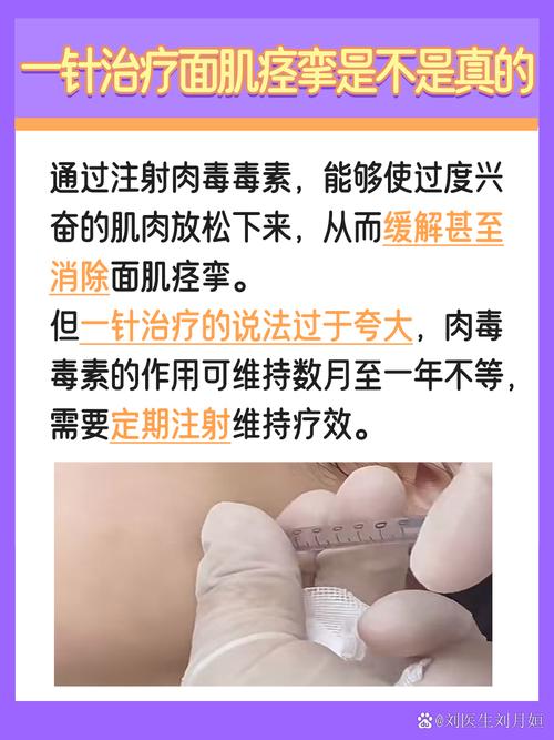 面肌痉挛针灸能治好吗