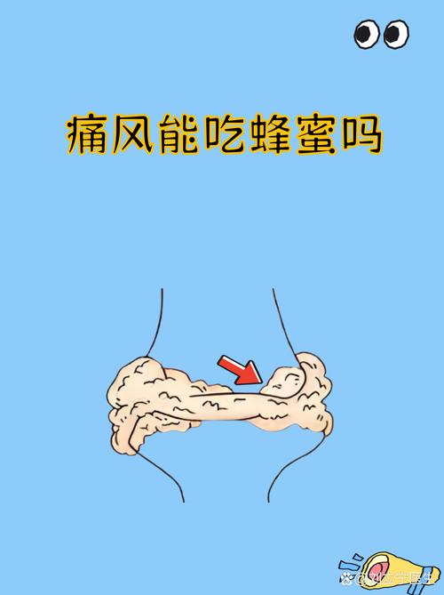 吃蜂蜜对痛风有好处吗