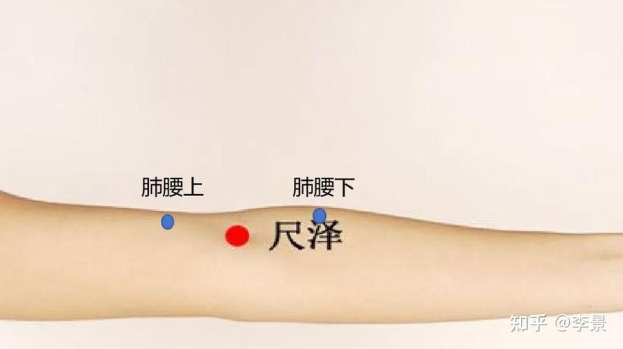 腰间盘突出针灸有用吗