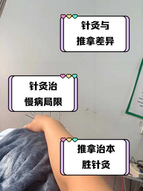 针灸和推拿哪个效果好