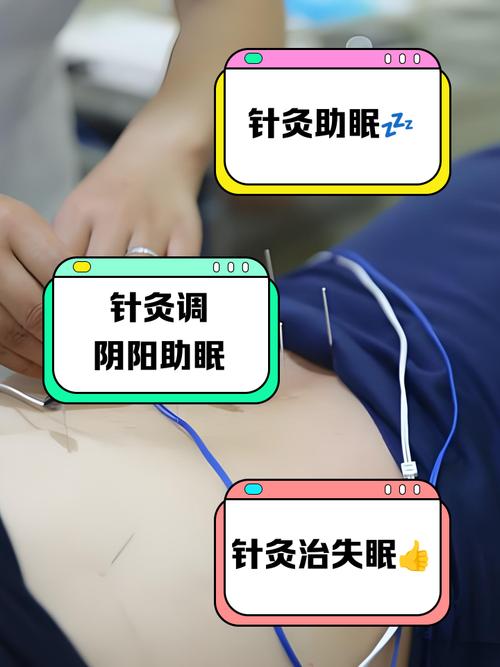针灸治疗失眠效果如何